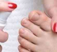 Грибок нігтів на ногах - причини, симптоми, профілактика, лікування, що важливо знати