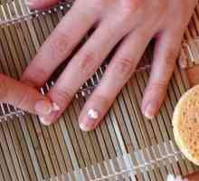 Як лікувати нігті, якщо вони шаруються
