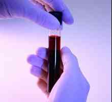 Біохімічний аналіз крові: нормальні показники