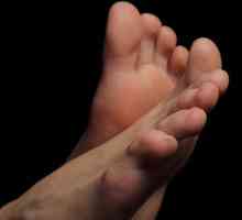 Що робити з вросшим нігтем на нозі