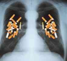 Як куріння впливає на легені