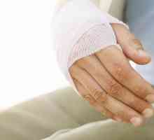 Як лікувати розтягнення руки