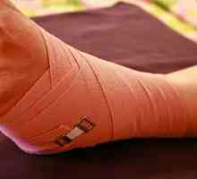 Як лікувати зв`язки на нозі