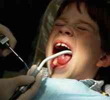 Як лікувати зуби маленьким дітям
