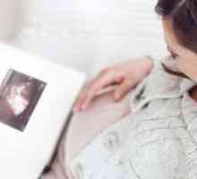 Як підготувати організм до вагітності?