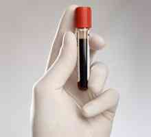 Як правильно здавати аналіз крові на кортизол