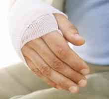 Як зняти набряк при переломі руки