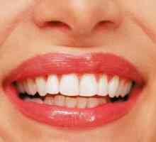 Як захистити передні зуби від карієсу
