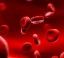 Низький рівень тромбоцитів у крові: причини, симптоми