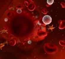 Про що свідчить низький рівень тромбоцитів у крові?