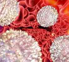 Чому можуть бути підвищені лейкоцити в крові