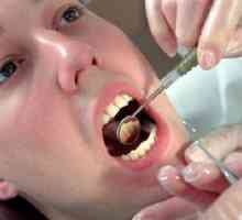 Чому може виникати кіста зуба