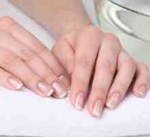 Чому з`являються білі смужки на нігтях: лікування