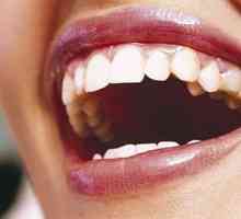 Чому зуби жовтіють