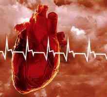 Попередження серцево-судинних захворювань і їх основні симптоми