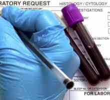 Розшифровка аналізу крові на онкомаркери