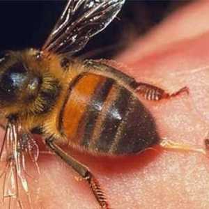 Що буде, якщо не витягнути жало бджоли