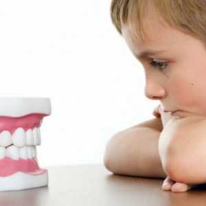 Як лікувати пульпіт молочних зубів