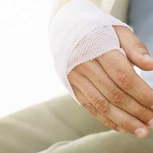 Як лікувати розтягнення руки