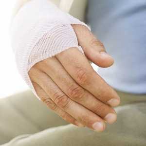 Як зняти набряк при переломі руки
