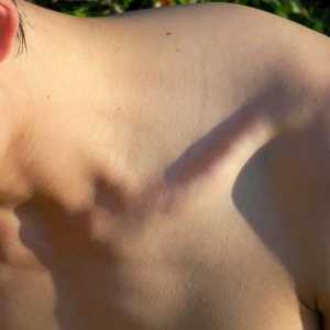 Як зміцнити м`язи шиї