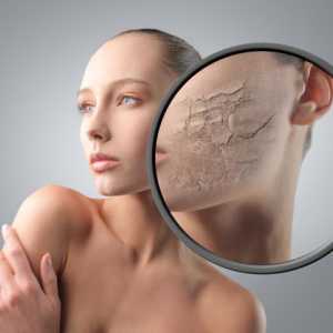 Як усунути лущення шкіри