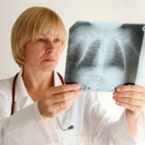 Як виникає рак легенів