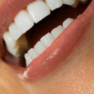 Як вилікувати зуб в домашніх умовах