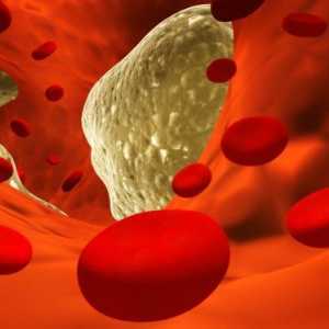 Яка норма холестерину в крові у здорової людини