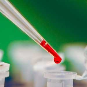 Основні причини низького вміст лейкоцитів в крові