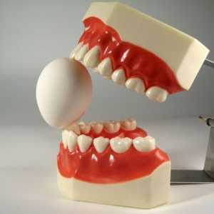 Чому випадають зуби