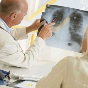 Рак легенів: симптоми, діагностика та лікування