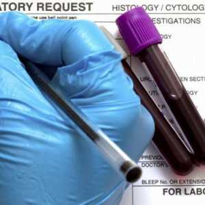 Розшифровка аналізу крові на онкомаркери